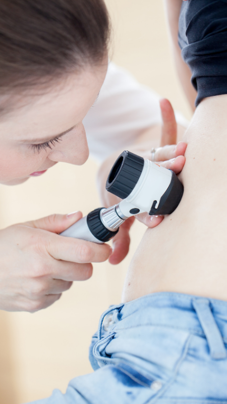 Dermatoscopio3