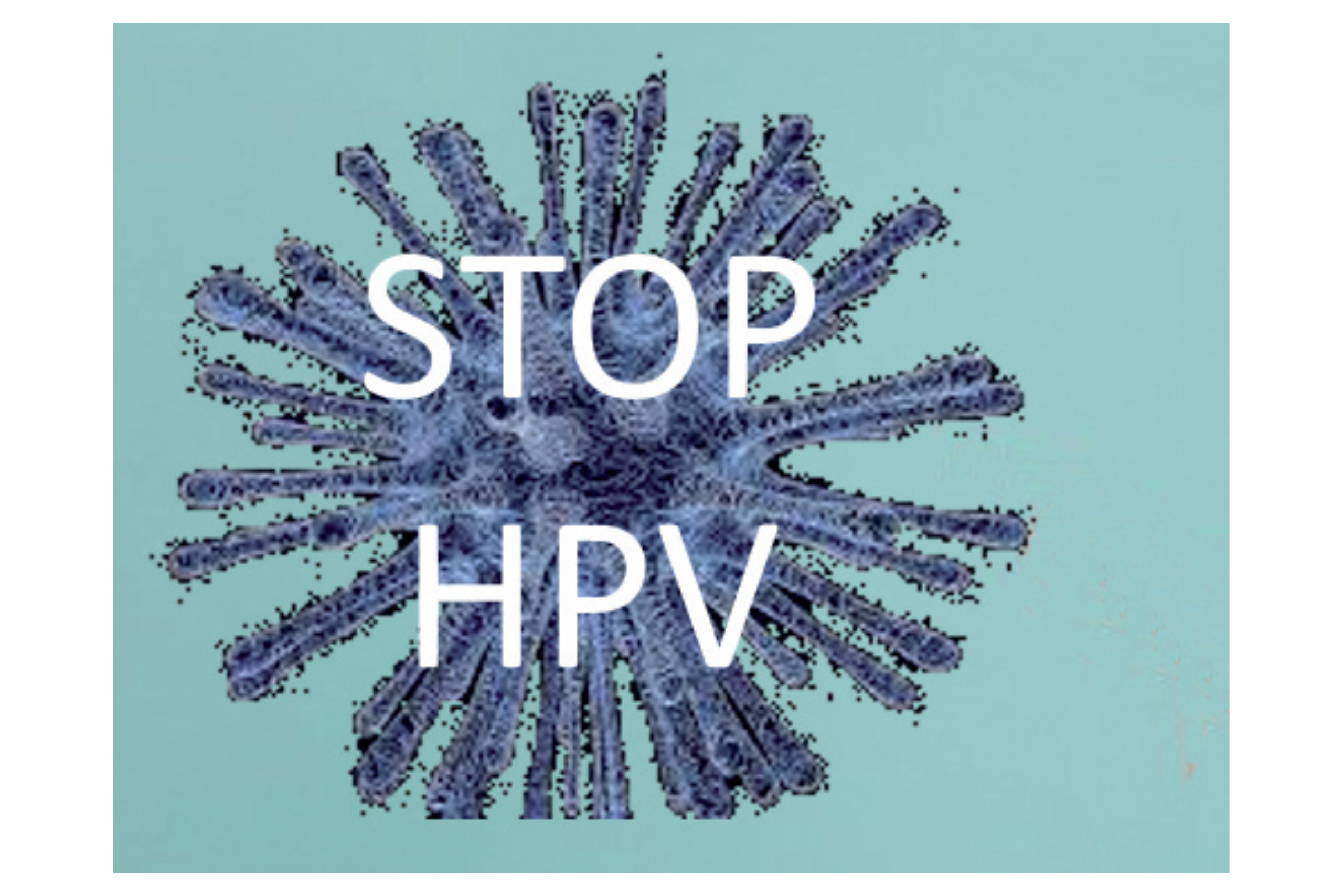 Stop HPV